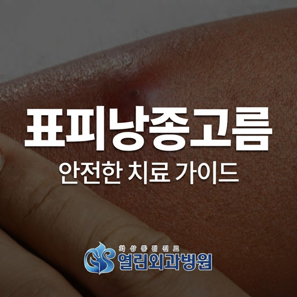 표피낭종 고름, 손으로 짜면 안되는 이유 3가지
