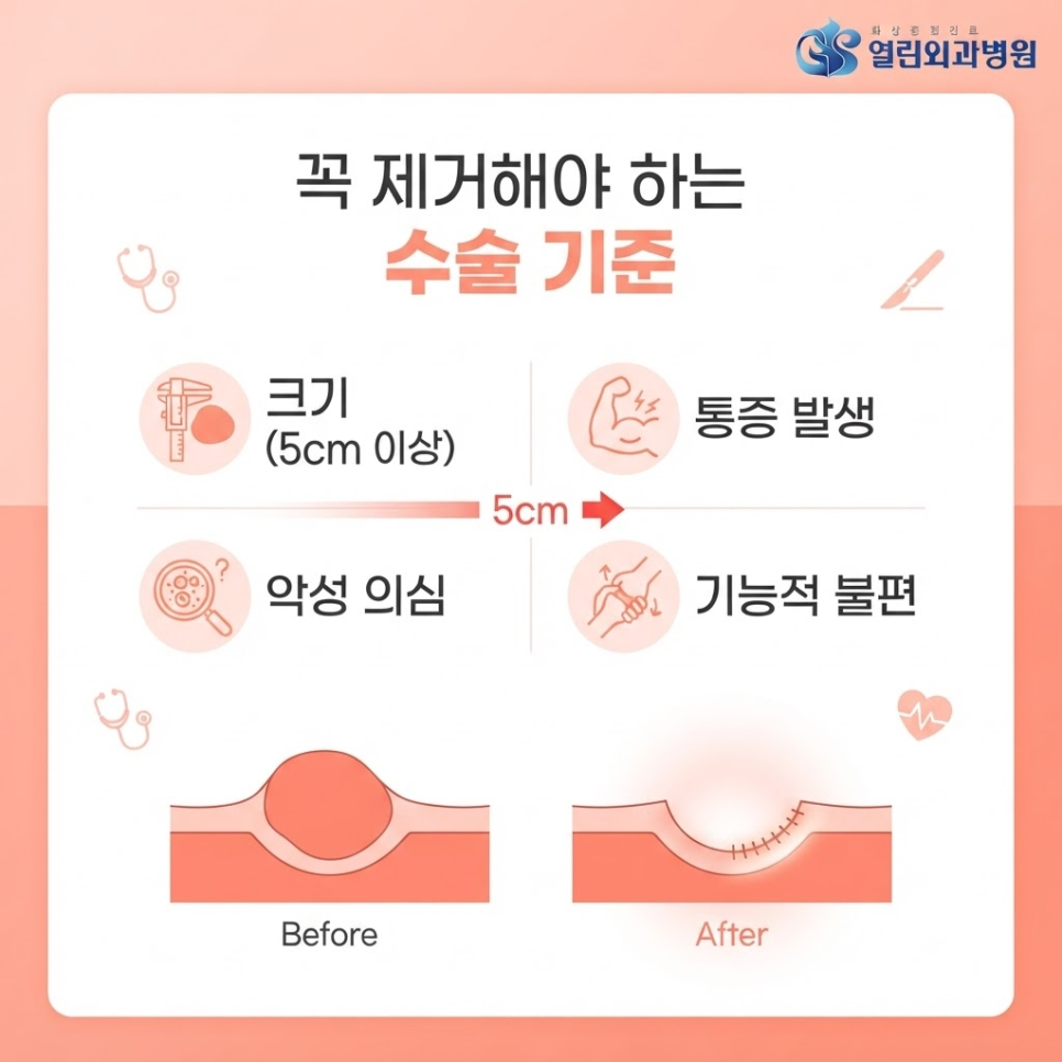 지방종 크기 관련 이미지 5