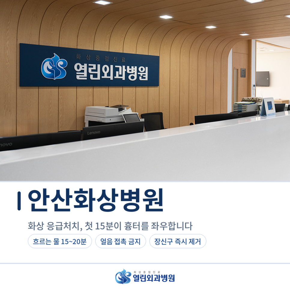 화상 응급처치
