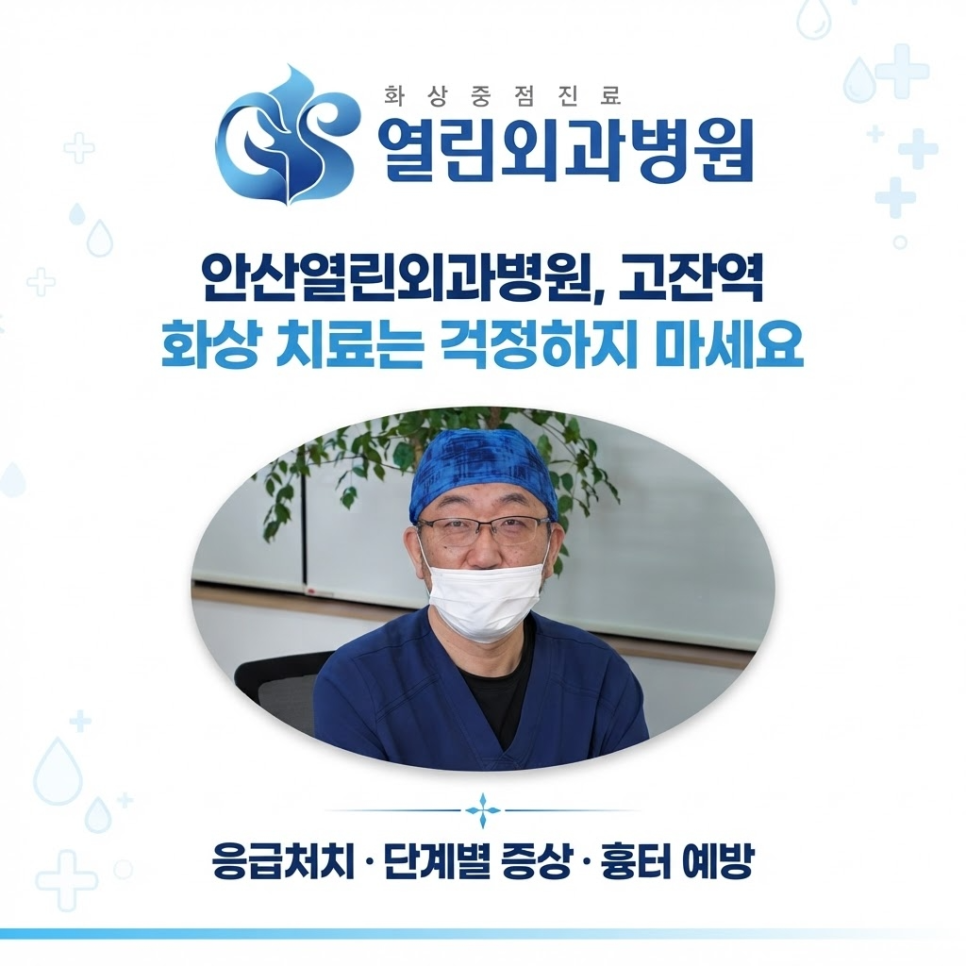 화상 응급처치