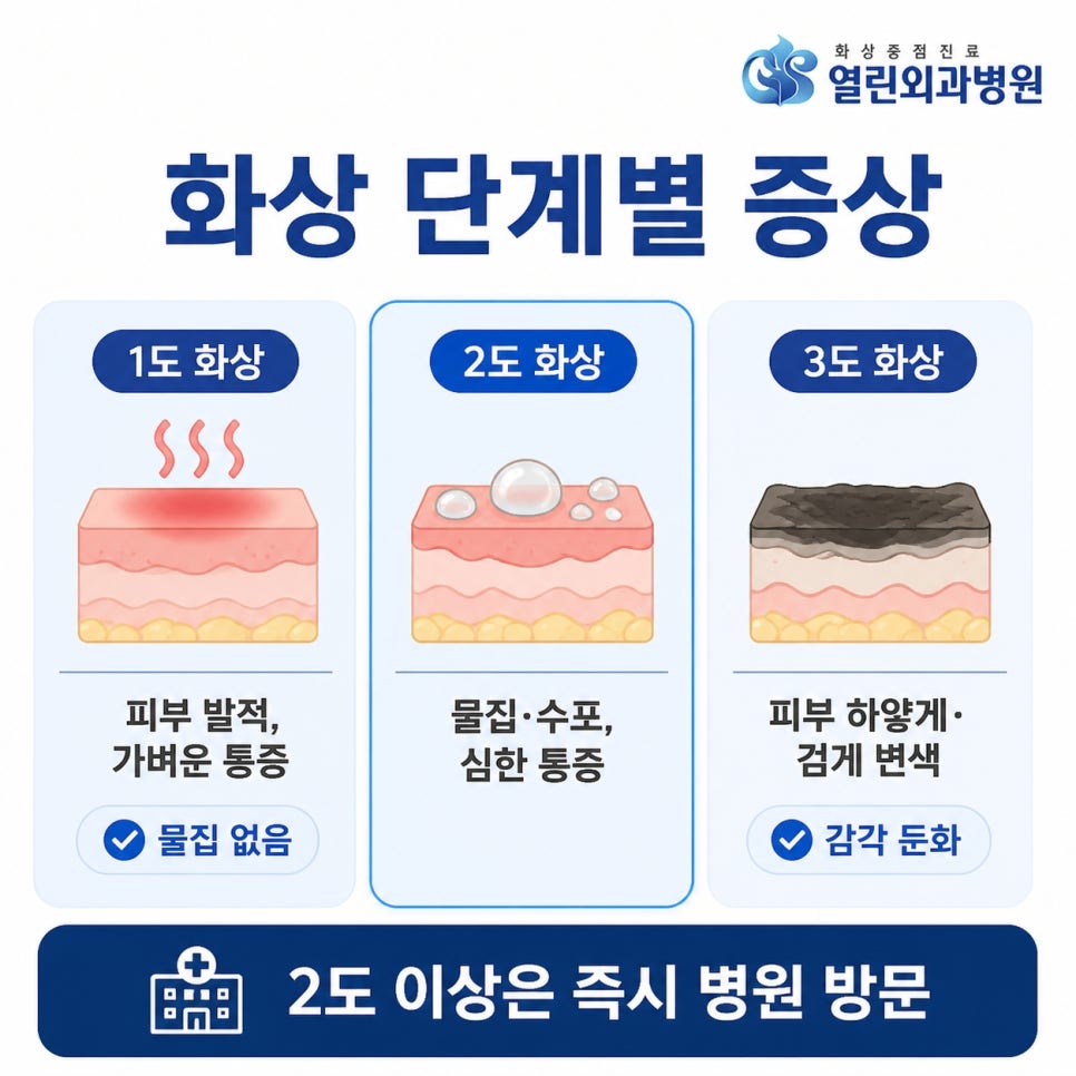 화상 응급처치 관련 이미지 6