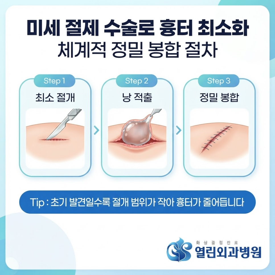 안산피지낭종 관련 이미지 6