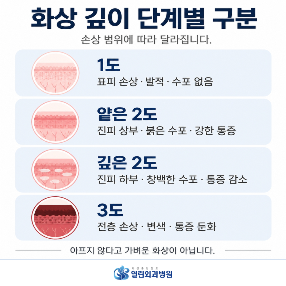 화상 응급처치 관련 이미지 8